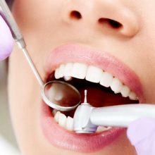 Актуальные аспекты реставрации зубов